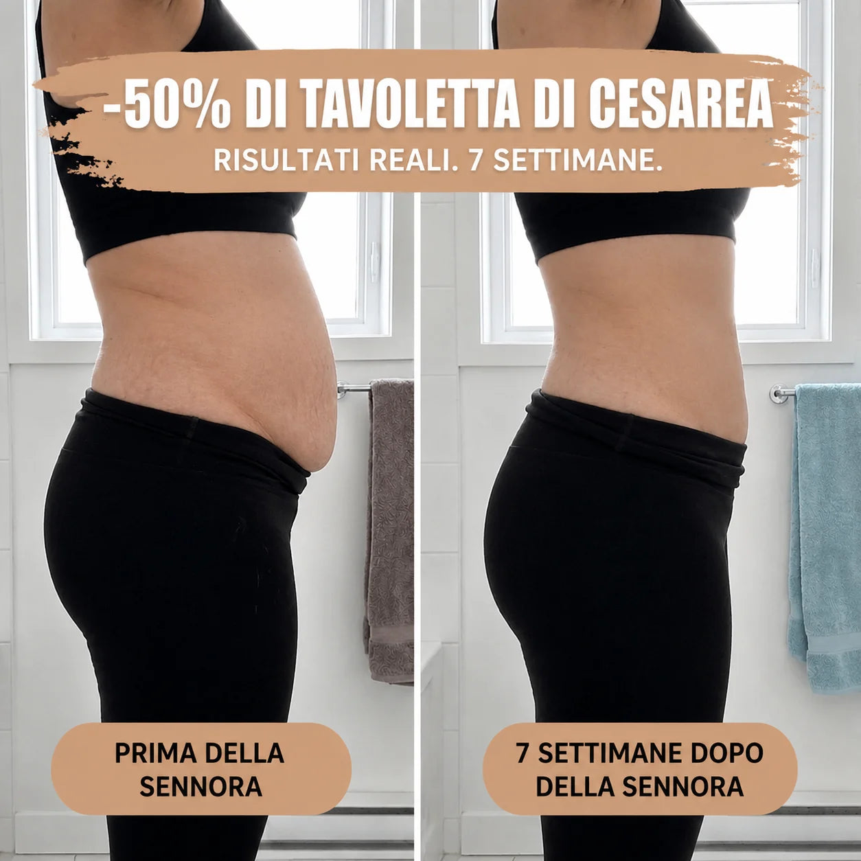 Slip Post-Parto — Compressione a 360°